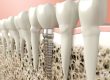 oral surgeon in chattanooga