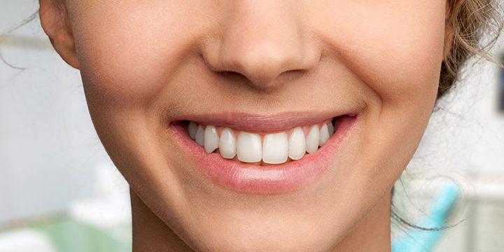 WhatIsSinusLiftSurgery