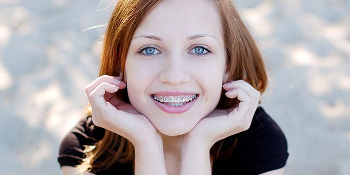 wisdom teeth and braces