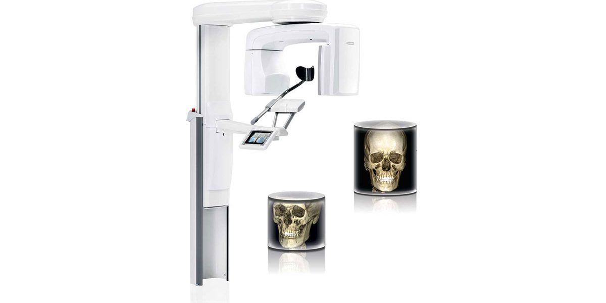 How Does C-Arm X-ray Work