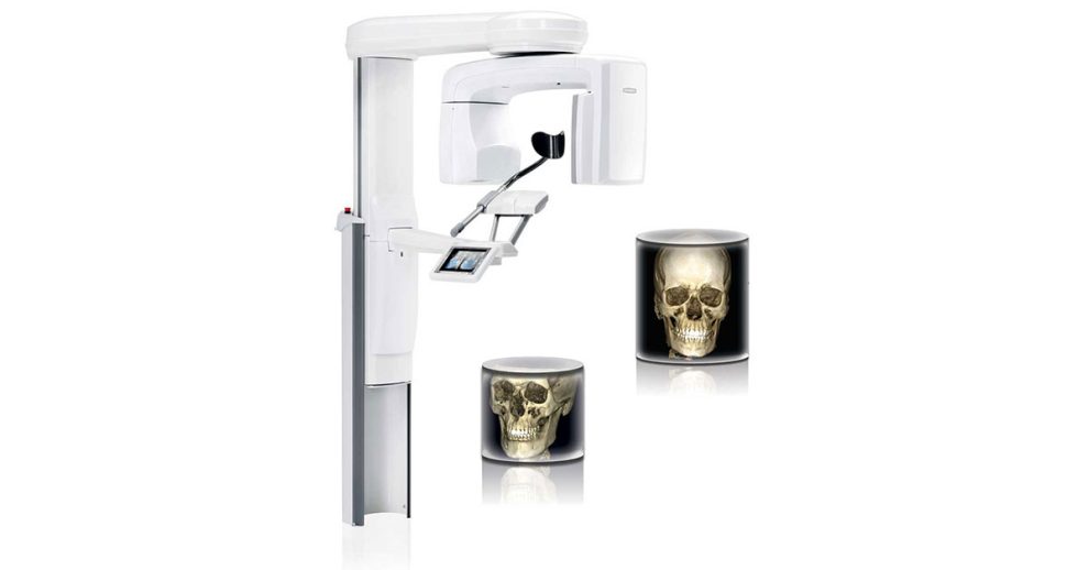 How Does C-Arm X-ray Work