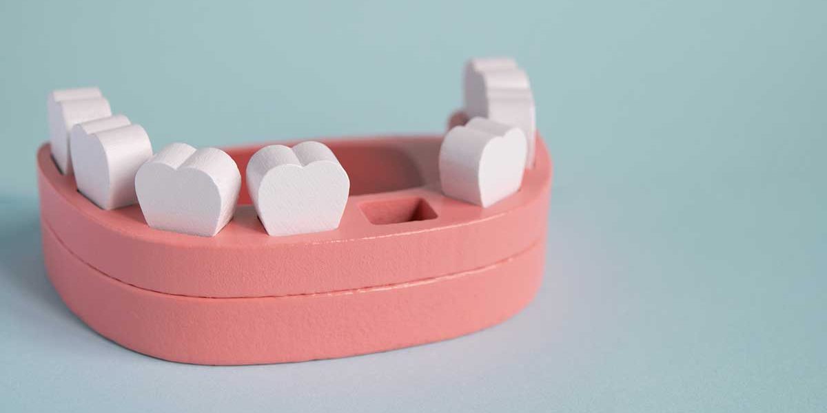 Can I Drive After a Tooth Extraction