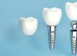 What if Your Dental Implant Gets Damaged